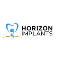 Horizon Implants